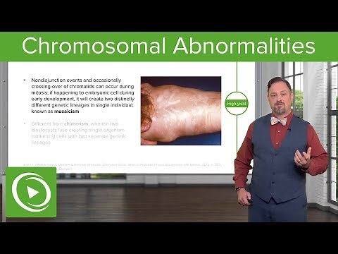 Chromosomal Abnormalities: Turner, Klinefelter & Rett Syndrome, Trisomy etc. – Embryology | Lecturio