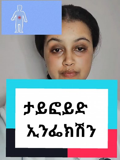 Understanding Typhoid Fever Symptoms and Treatment