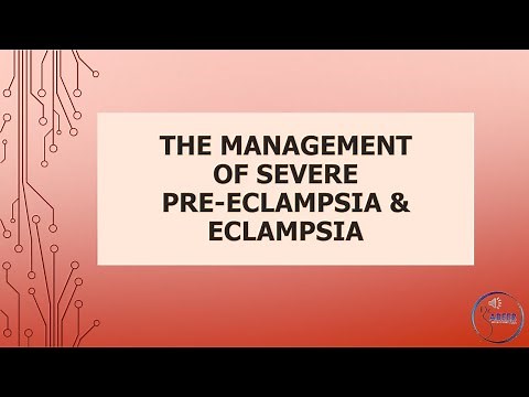 Advanced Obs & Gyne Lecture THE MANAGEMENT OF SEVERE PRE ECLAMPSIA & ECLAMPSIA Part 1