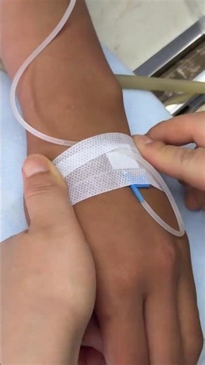 The Perfect Injection Guide | Intramuscular Injection Technique | Safe IV & IM Injection #shorts