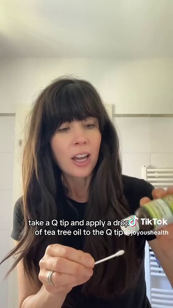 Tea tree oil is an effective natural way to get rid of a common wart, caused by a virus. #commonwart #wart #wartremoval #natural #holisticliving #nutritionist #joyoushealth #teatreeoil #teatreeoilbenefits