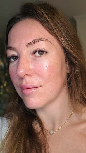 Start to finish with Roxy 💫 Korean fractional laser treatment boosting texture, clarity, and collagen. #Glassskin #koreanglow #laserfractional #mtl | PurLux Montreal