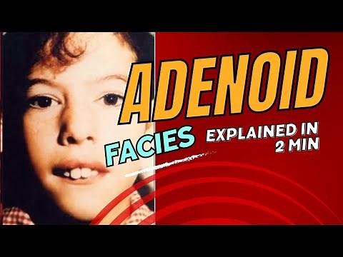 The Adenoid Face explained in 2 min