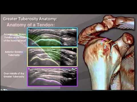 Webinar: Diagnostic Shoulder Ultrasound Exam - Part 2