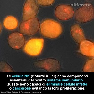 13K views · 181 reactions | L’IMPORTANZA DELLE CELLULE NK...