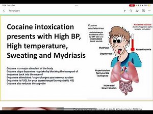 Signs of cocaine intoxication