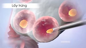 Kinh nghiệm trước khi chuyển phôi để thành công ngay từ lần đầu