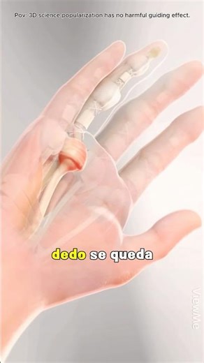 Trigger Finger Surgery 3D Animation#3d #doctor #health #finger #surgery