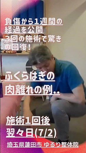 【ゆるり整体院】ふくらはぎの肉離れが３回の施術で激変！ ７日間の経過をまとめました #Shorts #小波津式 #肉離れ #スポーツ障害