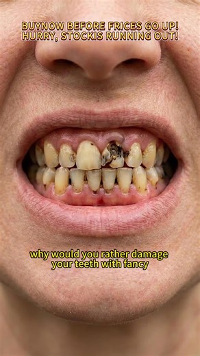 Tooth Powder: Natural Ingredients for Dental Care