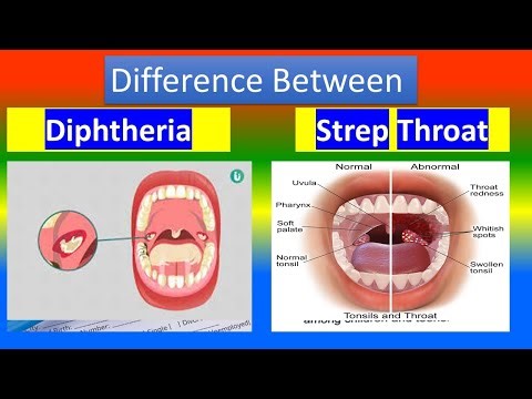 Diphtheria Vs. Strep Throat