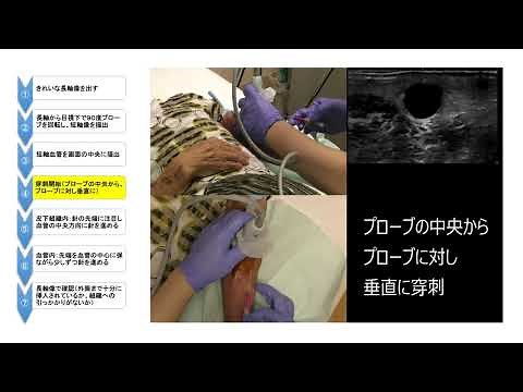 Echo-guided puncture video manual ⑥ Echo-guided puncture and pitfalls (1) (Practical and explanat...