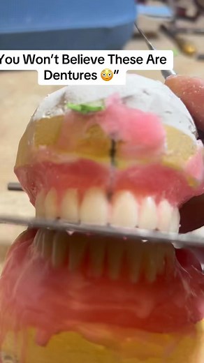Watch the full transformation from a simple wax try-in to a beautiful finished denture. Every step brings the smile closer to life — precision, art, and passion in every detail. 💪 Hashtags: #denture #smiletransformation #denturelab #dentureprocess #beforeandafter | JOs Dentures Lab