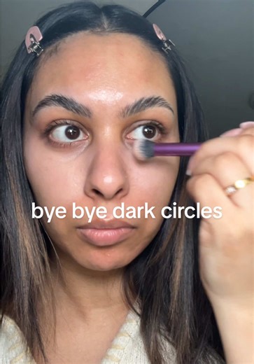 Erase Dark Circles with Charlotte Tilbury Magic Vanish