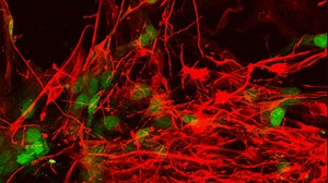 New ALS Gene and Signaling Pathways Identified