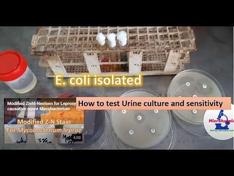 How to test urine culture and sensitivity