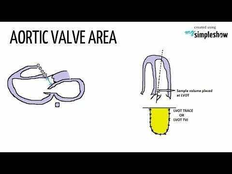 CONTINUITY EQUATION IN ECHOCARDIOGRAPHY-HEART AND TECHY