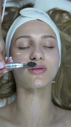 Non-Invasive Lip & Eye Rejuvenation with Zemits DermeBoost