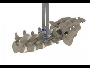 Inspan Technique Animation