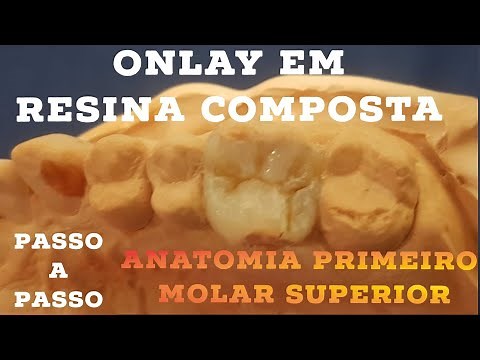 🛑ONLAY EM RESINA COMPOSTA: BONUS ANATOMIA FÁCIL DO PRIMEIRO MOLAR SUPERIOR🤫✍