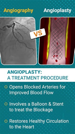 Angiography vs Angioplasty — Know the difference!