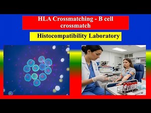 HLA Crossmatching - B cell crossmatch test - Definition, Uses, Preparation, Results, Normal Values