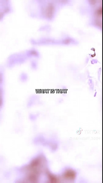 Understanding Hyperpigmentation and Its Types