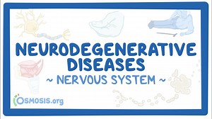 Nervous system: Neurodegenerative diseases: Video, Causes, & Meaning | Osmosis