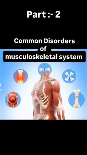 disorders of Musculoskeletal system | Adult health nursing