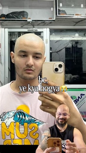 Creatine causes baldness?