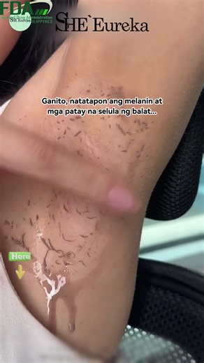 Effective Skin Brightening with SHE Eureka Exfoliating Gel