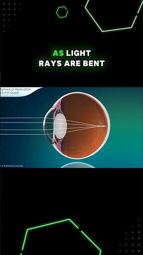 Why Squinting Improves Your Vision - Spherical Aberration