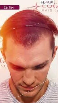 A Transformation That Rewinds Time | Rafael’s Hair Journey.