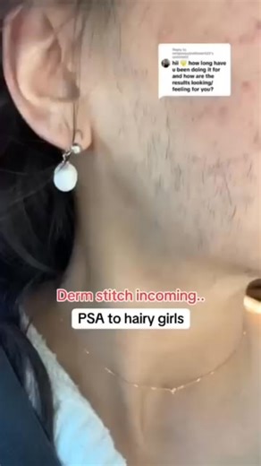 🥰Say goodbye to waxing and shaving! Luxeveria Facial Hair Removal Cream deliverssmooth, irritation-free skin in just 5 minutes 🥰Powered by our patented DermacureComplex it dissolves hair at the root while soothing sensitive facial skin with aloe vera andchamomile ❤Try it now risk-free with our 60-day money-back guarantee! 💥Order Now - Get 50% Off!👍 | Conner Leslie Samantha