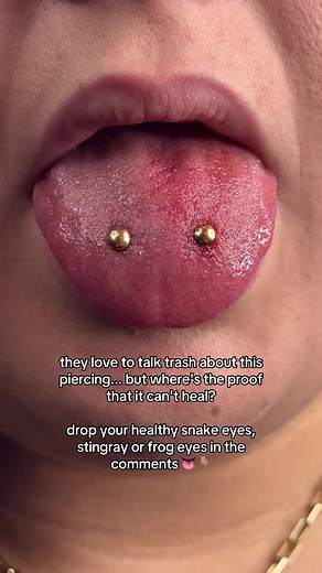 I still do these piercings because they heal. 😮‍💨 I speak from 7.5 years of real-life experience, not theory. People love to talk, but never placed one themselves. Not here for the myths, just real stories and flawless piercings 😌 Yes, like any piercing, there can be complications — But it’s never as dramatic as the internet makes it seem. These piercings? Surface-level = less trauma, easier healing. Only surface swelling. But a regular tongue piercing? It goes through every layer of your ton