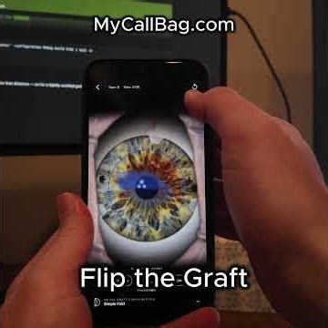 DMEK Simulator - My Call Bag