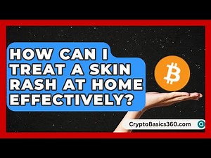How Can I Treat a Skin Rash at Home Effectively? | Allergy Relief Guide