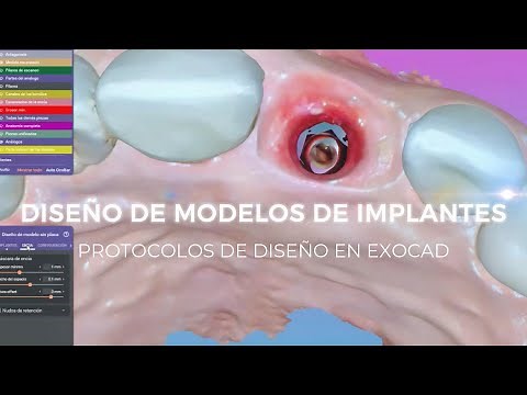 IMPLANT MODEL DESIGN - EXOCAD MODEL CREATOR