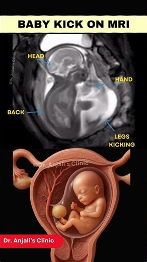 Real MRI Footage: See Baby Moving in Womb