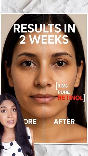 How long Retinal, Retinol, Tretinoin take to work? #retinal #retinol #skincare #antiaging