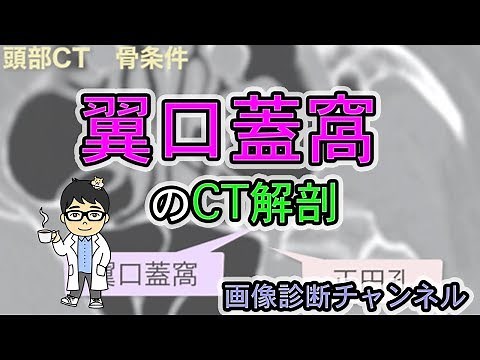 翼口蓋窩のCTにおける解剖、図
