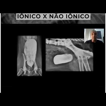Tipos de contraste iodado