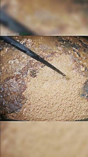 Essential Drain Maintenance: How to Avoid Clogs