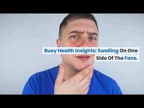 Swelling on One Side of the Face: Common Causes and When to Seek Medical Care | BuoyHealth.com