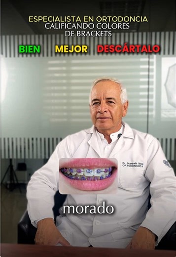Colores de Brackets: Los Mejores para Tu Sonrisa