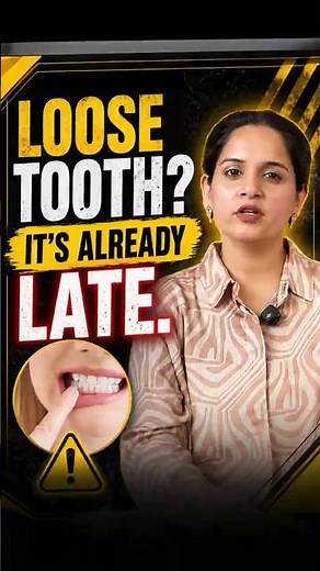 Loose teeth