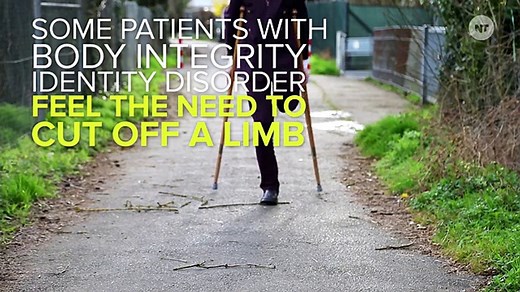 These Men Live Life As Amputees — By Choice