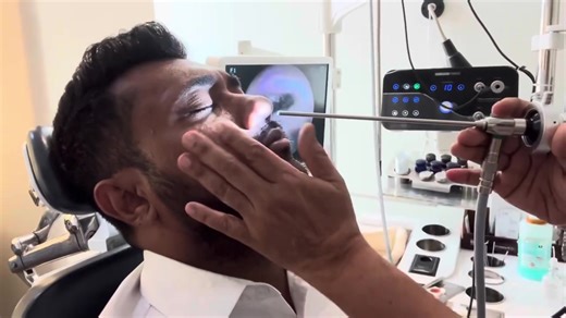 #abscess#nose#hairtrmoval#braininfecrion