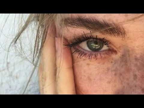 ✨ • Get freckles In under 24 hours || Subliminal • ✨