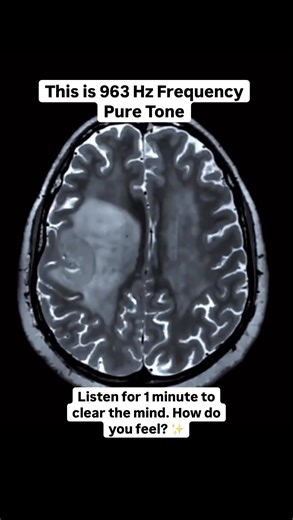 7.1M views · 955 reactions | This is 963 Hz Frequency Pure Tone | Listen for 1 minute at a comfortable volume. 963 Hz, known as the ‘frequency of God’ ~ listen to music tuned to this frequency to boost intuition & spiritual guidance in your life! ❤️ How do you feel?  #meditation #meditationmusic #frequency #solfeggiofrequencies #963hz #sleepmusic #healingmusic #mentalhealth #soundtherapy #frequencyhealing | 5D Waves | Facebook